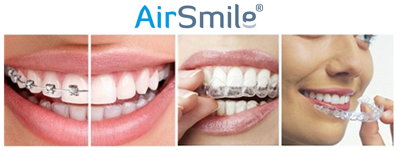 AirSmile® - Mondzorg Wandelweg Wormerveer